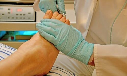 pedicure curativa ed estetica pedicure curativa ed estetica